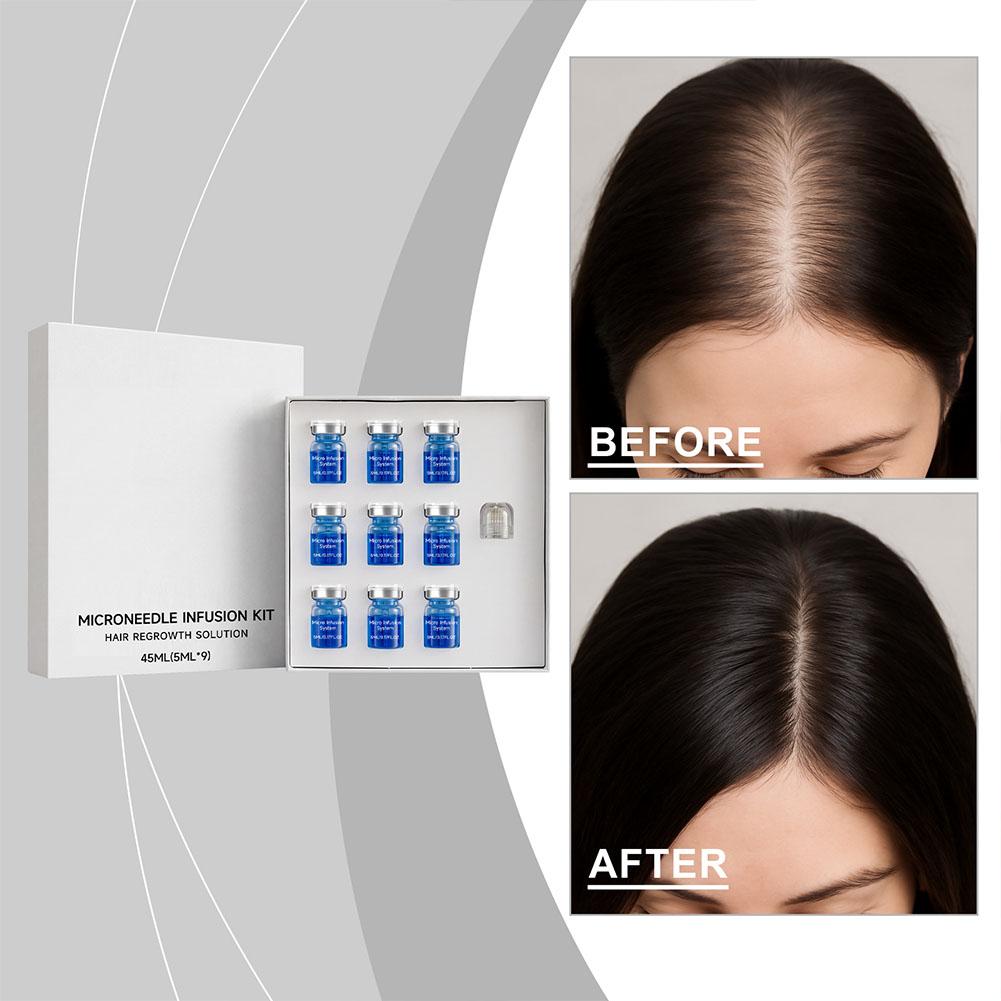 Kit de Rolo de Microagulhas co - Hair Care Kit avaliação e preço