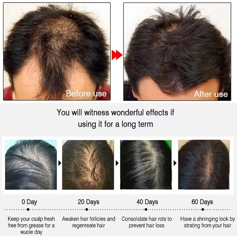 Spray de Crescimento Rápido de - Hair Care Vegan avaliação e preço